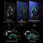 Hệ thống 3864 vùng đèn nền